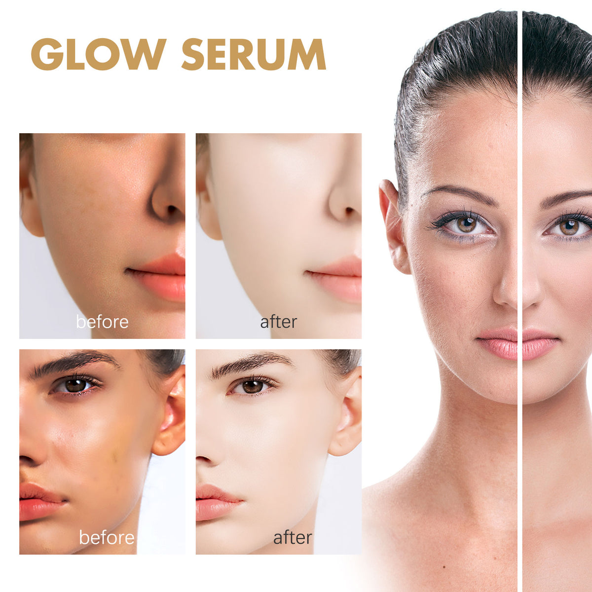 Propolis Nicotinamide Photosensitive Essence, Reduces Acne Marks Moisturizes Brightens And Whitens Facial Essence