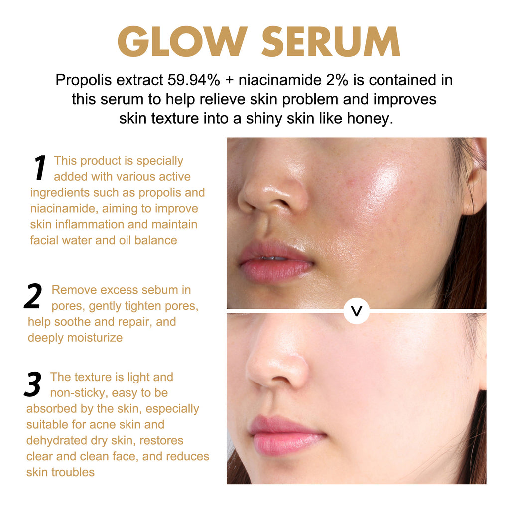 Propolis Nicotinamide Photosensitive Essence, Reduces Acne Marks Moisturizes Brightens And Whitens Facial Essence
