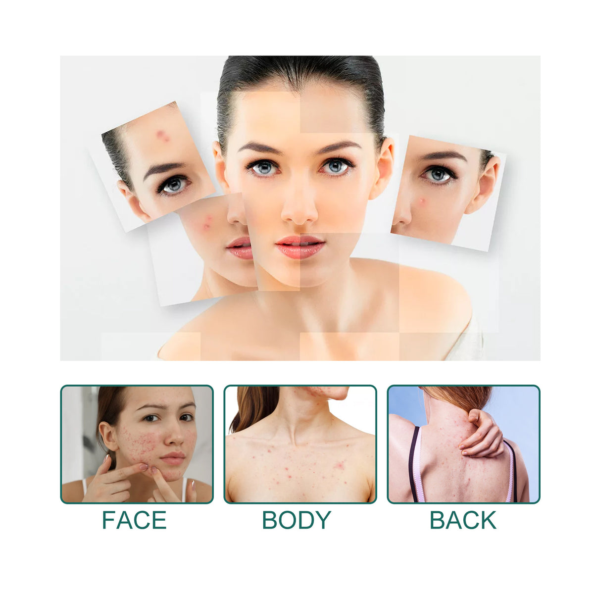 EELHOE Star Acne Patch Gentle Cleansing Lighten Acne Soothing Skin Acne Patch Facial Cleansing Treatment