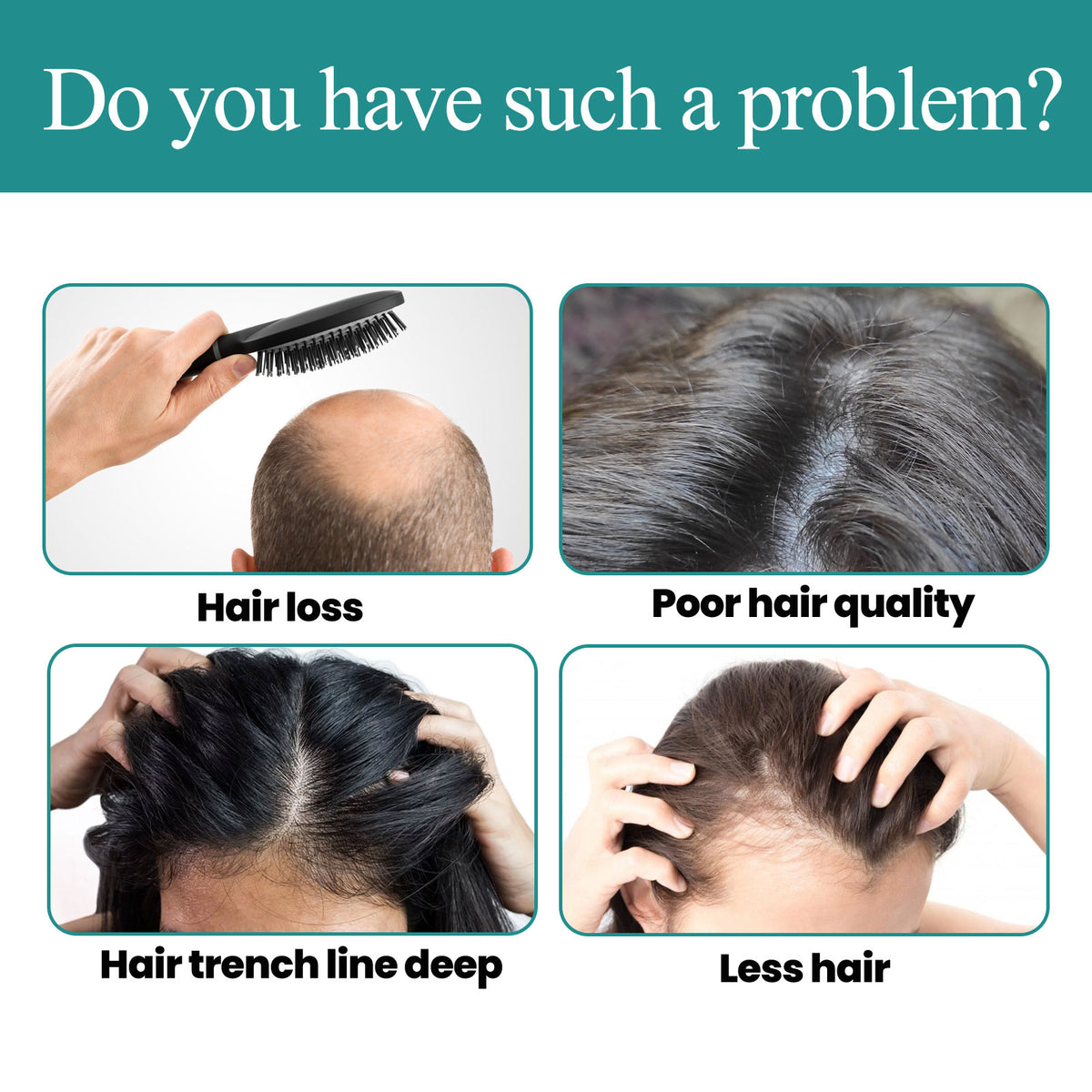 Hair Care Essence, Nourishing And Moisturizing Hair, Soothing Hair And Scalp Massage Essence
