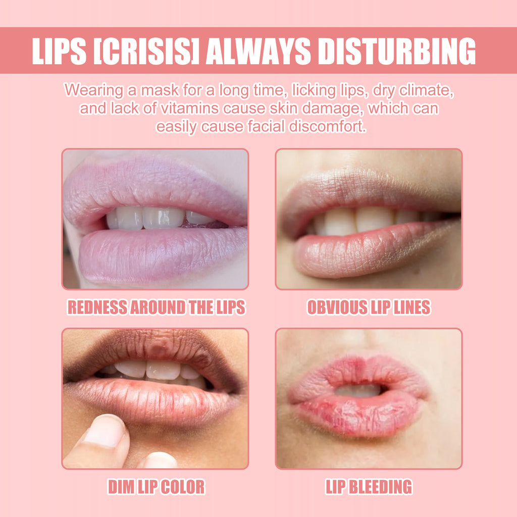 Lip Mask Lightening Lip Lines, Hydrating, Moisturizing, Removing Dead Skin, Anti-Freezing And Cracking, Non-Greasy And Easy To Absorb Lip Balm
